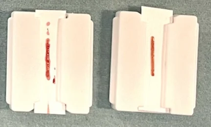 Zwei weiße Probenträger auf grünem Untergrund; auf jedem liegt ein dünner, rötlicher Gewebezylinder aus einer Nadelbiopsie der Niere.