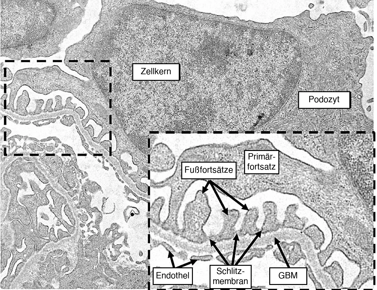 Elektronenmikroskopische Aufnahme der glomerulären Filtrationsbarriere: Zellkern und Zellkörper eines Podozyten, darunter Primär- und Fußfortsätze auf der glomerulären Basalmembran; zwischen den Fußfortsätzen die Schlitzmembranen, auf der Kapillarseite das gefensterte Endothel.