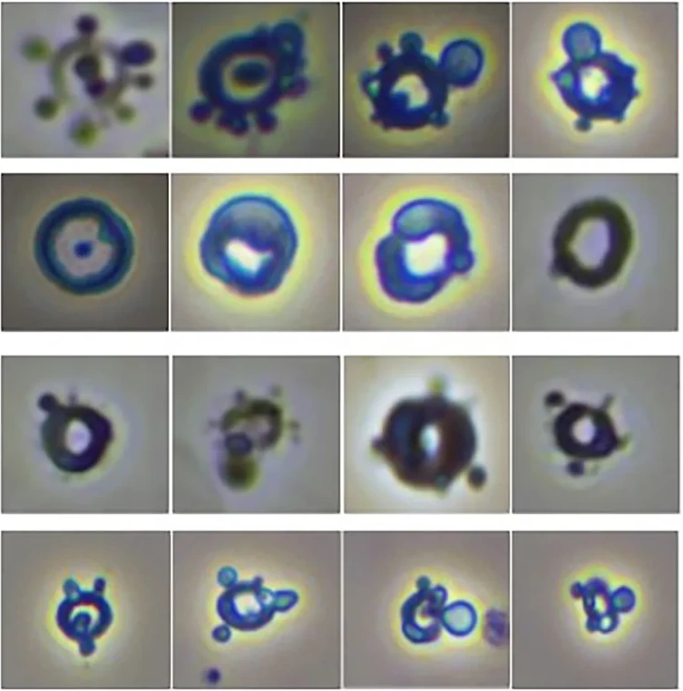 Raster aus 16 Einzelzellen im Phasenkontrast, alle unregelmäßig geformt, unten Ringformen mit kleinen Bläschen