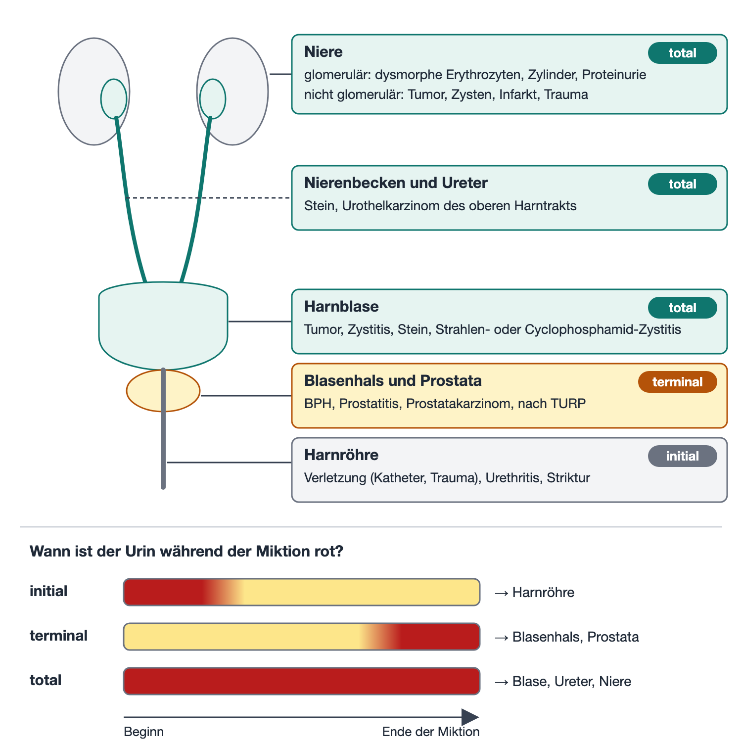 Schema des Harntrakts mit Blutungsorten und drei Balken für initiale, terminale und totale Hämaturie