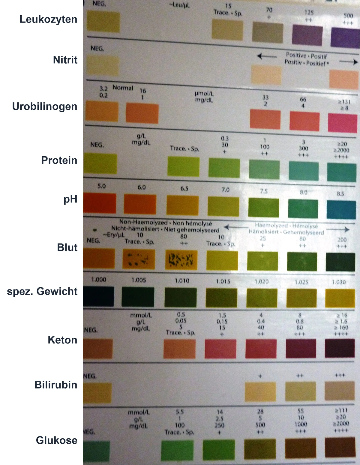 Farbskala eines Urinteststreifens mit zehn beschrifteten Testfeldern von Leukozyten bis Glukose und ihren Farbstufen von negativ bis stark positiv