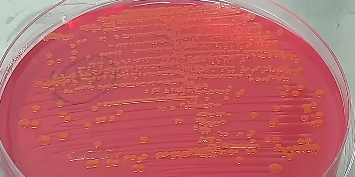 Agarplatte mit rotem Nährboden; viele runde, gelblich-orange glänzende Kolonien entlang von Ausstrichlinien, links eine dunkle Kreismarkierung
