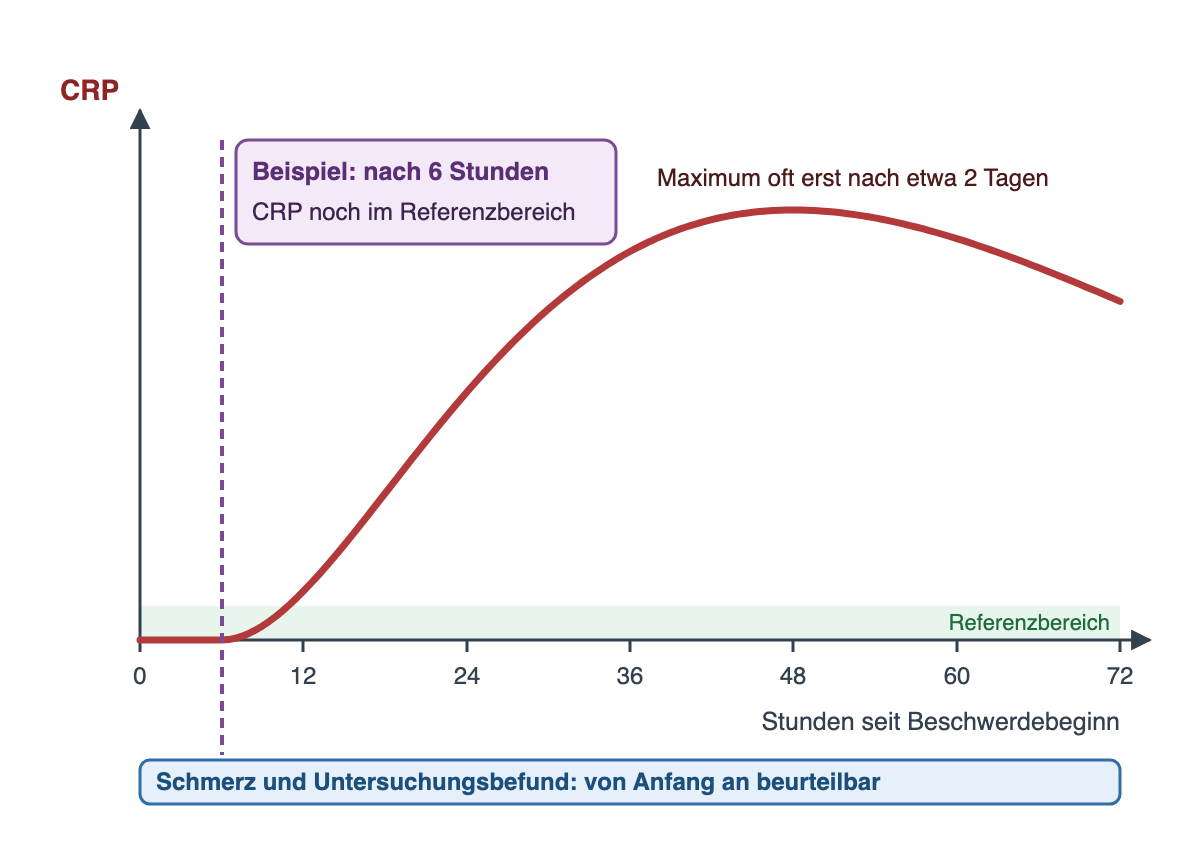 Verlaufsdiagramm des CRP über 72 Stunden seit Beschwerdebeginn. Die Kurve bleibt in den ersten Stunden im grün markierten Referenzbereich, steigt dann an und erreicht ihr Maximum nach etwa 48 Stunden. Eine gestrichelte Linie bei 6 Stunden ist beschriftet: Beispiel nach 6 Stunden, CRP noch im Referenzbereich. Ein Balken unter der Zeitachse zeigt: Schmerz und Untersuchungsbefund sind von Anfang an beurteilbar.