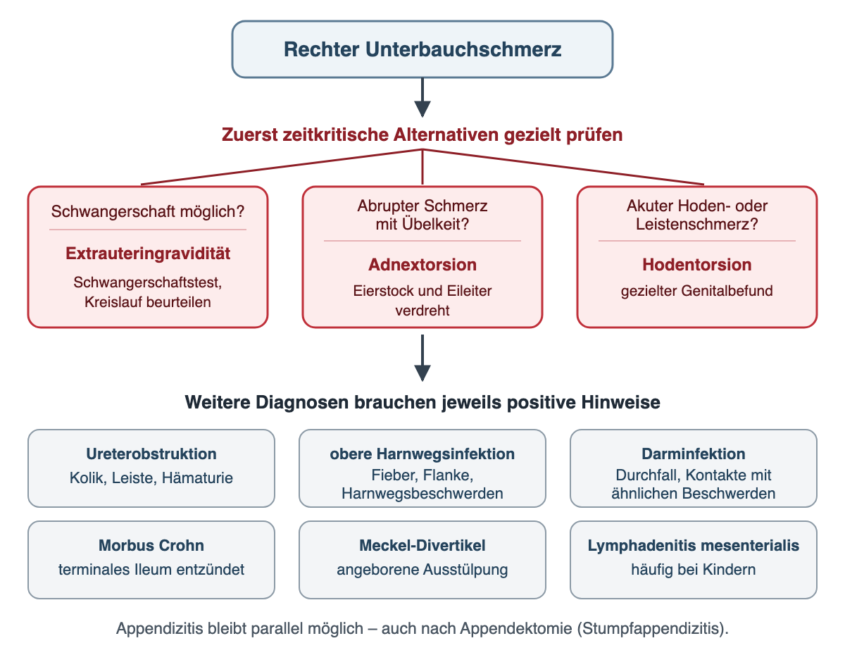 Entscheidungsschema. Oben: Rechter Unterbauchschmerz. Darunter: Zuerst zeitkritische Alternativen gezielt prüfen, in drei roten Kästen: Schwangerschaft möglich? – Extrauteringravidität, Schwangerschaftstest, Kreislauf beurteilen; abrupter Schmerz mit Übelkeit? – Adnextorsion, Eierstock und Eileiter verdreht; akuter Hoden- oder Leistenschmerz? – Hodentorsion, gezielter Genitalbefund. Darunter: Weitere Diagnosen brauchen jeweils positive Hinweise, in sechs grauen Kästen: Ureterobstruktion, obere Harnwegsinfektion, Darminfektion, Morbus Crohn, Meckel-Divertikel, Lymphadenitis mesenterialis, jeweils mit ihren Hinweisen. Unten: Appendizitis bleibt parallel möglich – auch nach Appendektomie (Stumpfappendizitis).