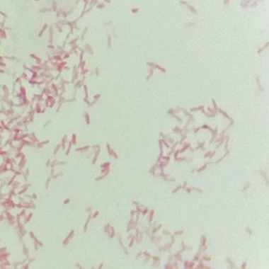 Lichtmikroskopisches Bild nach Gramfärbung: zahlreiche kleine, rosarot gefärbte, kurze stäbchenförmige Bakterien, teils einzeln, teils in Gruppen, auf hellem Hintergrund.