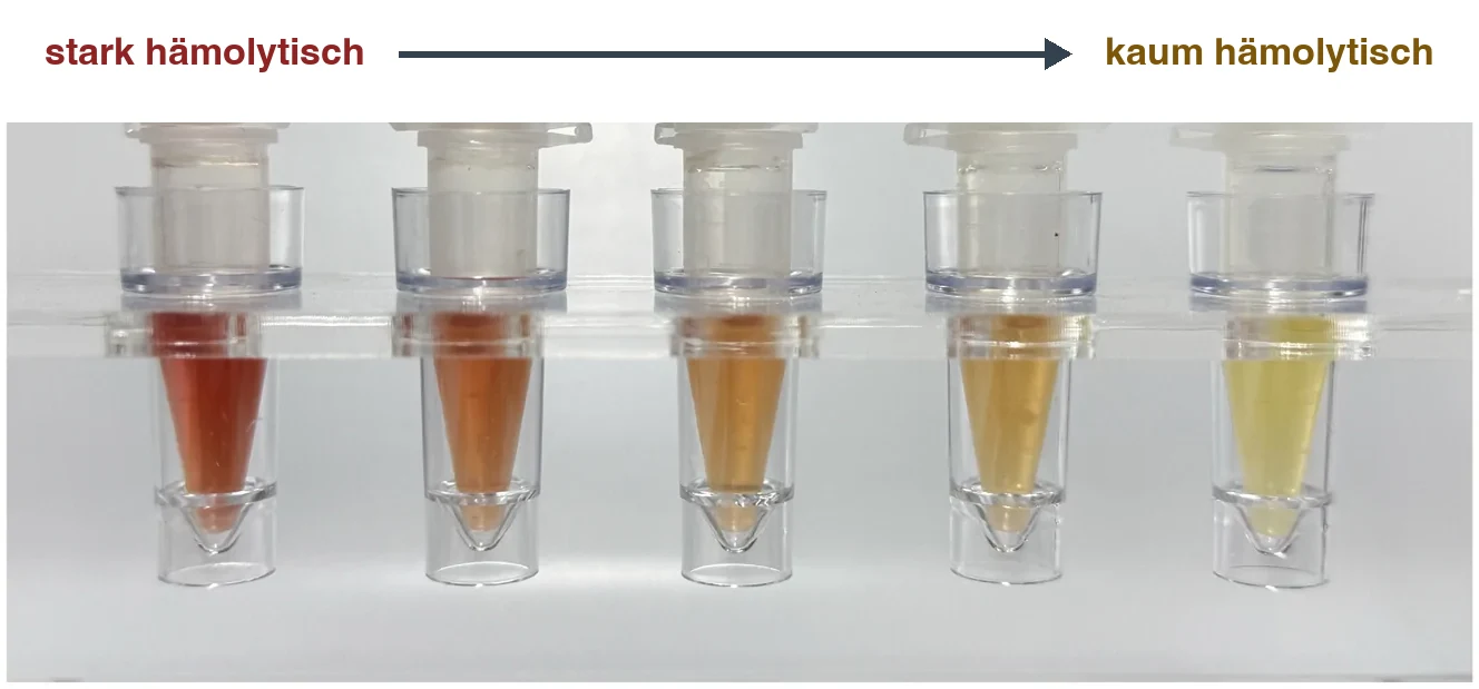 Fünf kleine Probenröhrchen mit Plasma nebeneinander. Von links nach rechts wechselt die Farbe von dunklem Rot über Orange zu hellem Gelb; ein Pfeil über den Röhrchen führt von stark hämolytisch nach kaum hämolytisch.