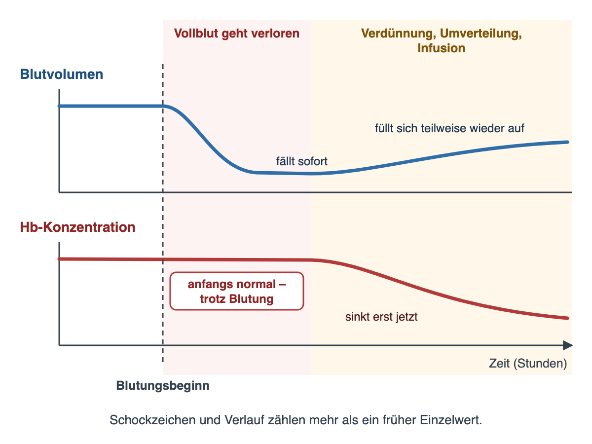 Zweiteiliges Verlaufsdiagramm über die Zeit mit gestrichelter Linie beim Blutungsbeginn. Oben fällt das Blutvolumen sofort ab und füllt sich später teilweise wieder auf. Unten bleibt die Hb-Konzentration während des Vollblutverlusts zunächst normal und sinkt erst in der Phase von Verdünnung, Umverteilung und Infusion. Darunter der Satz: Schockzeichen und Verlauf zählen mehr als ein früher Einzelwert.