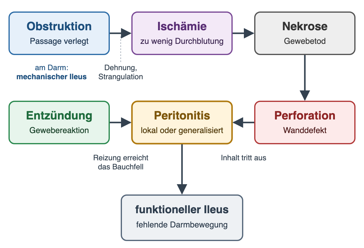 Flussdiagramm: Obstruktion führt über Dehnung oder Strangulation zur Ischämie, diese zur Nekrose und weiter zur Perforation. Perforation und Entzündung münden in eine lokale oder generalisierte Peritonitis; die Peritonitis kann einen funktionellen Ileus mit fehlender Darmbewegung auslösen. Am Darm entspricht die Obstruktion einem mechanischen Ileus.