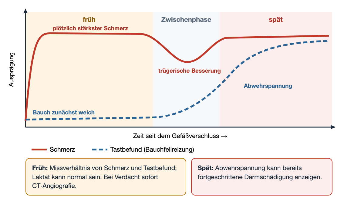 Zeitverlaufsschema der akuten mesenterialen Ischämie: Der Schmerz ist früh maximal, während der Tastbefund lange weich bleibt; eine trügerische Besserung ist möglich; Abwehrspannung tritt erst spät auf.