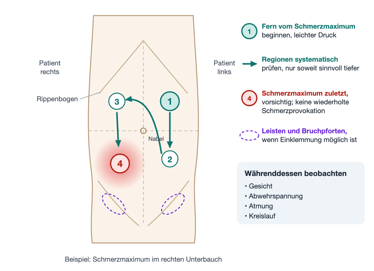 Schematischer Rumpf von vorn mit Rippenbogen, Nabel, Quadrantenlinien und Leisten. Das Schmerzmaximum liegt im rechten Unterbauch. Nummerierte Kreise zeigen den Beginn im linken Oberbauch, dann linker Unterbauch, rechter Oberbauch und zuletzt das Schmerzmaximum; gestrichelte Ovale markieren beide Leisten. Daneben die Hinweise, fern vom Maximum mit leichtem Druck zu beginnen, das Maximum zuletzt und vorsichtig zu untersuchen und währenddessen Gesicht, Abwehrspannung, Atmung und Kreislauf zu beobachten.