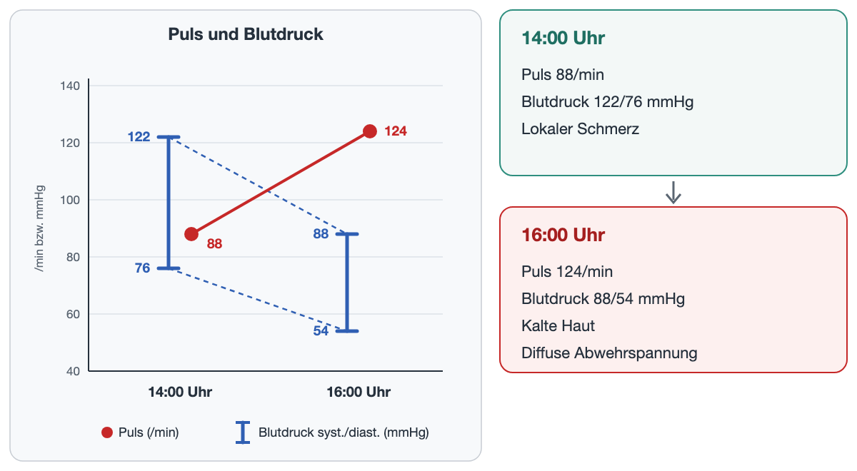 Fiktiver Verlauf: links ein Diagramm mit zwei Zeitpunkten. Der Puls steigt von 88/min um 14:00 Uhr auf 124/min um 16:00 Uhr; der Blutdruck, als Balken von diastolisch bis systolisch gezeichnet, fällt von 122/76 mmHg auf 88/54 mmHg. Rechts zwei Befundkarten: 14:00 Uhr Puls 88/min, Blutdruck 122/76 mmHg, lokaler Schmerz; 16:00 Uhr Puls 124/min, Blutdruck 88/54 mmHg, kalte Haut, diffuse Abwehrspannung.